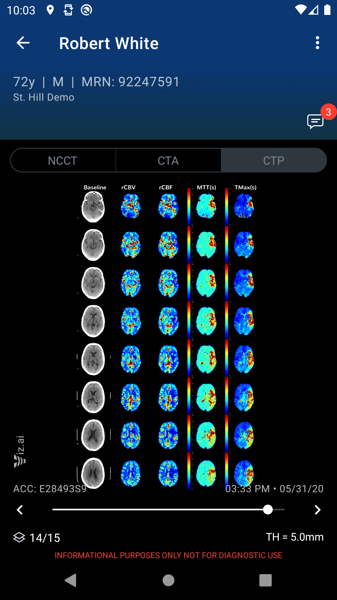 Viz.ai screenshot