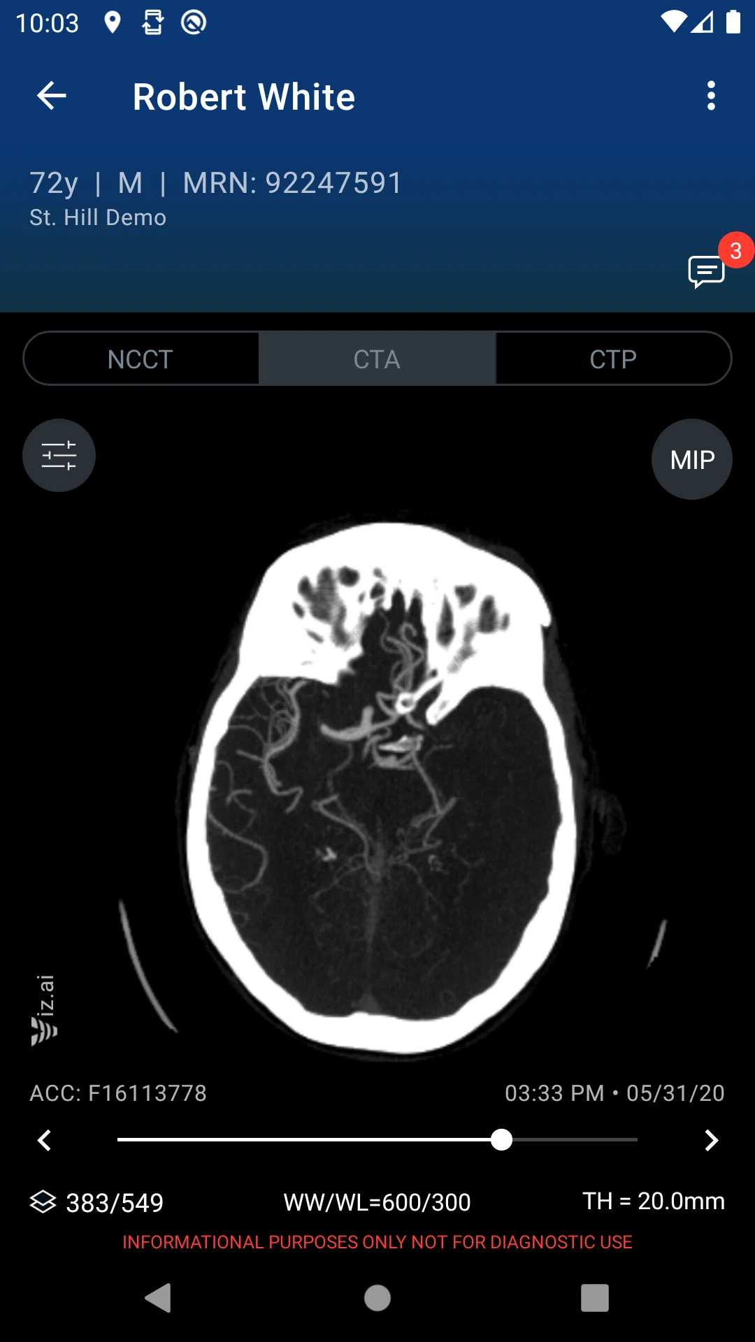 Viz.ai screenshot